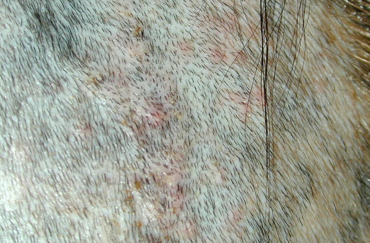 皮膚の細菌感染症を防ぐことはできるのでしょうか？